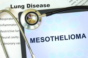 lung disease -Mesothelioma