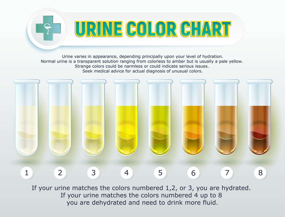Dehydration Urine Colour Infographic